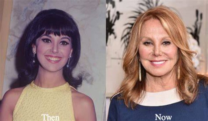 Marlo Thomas Plastic Surgery Did The Actress Get Surgery To Change Her