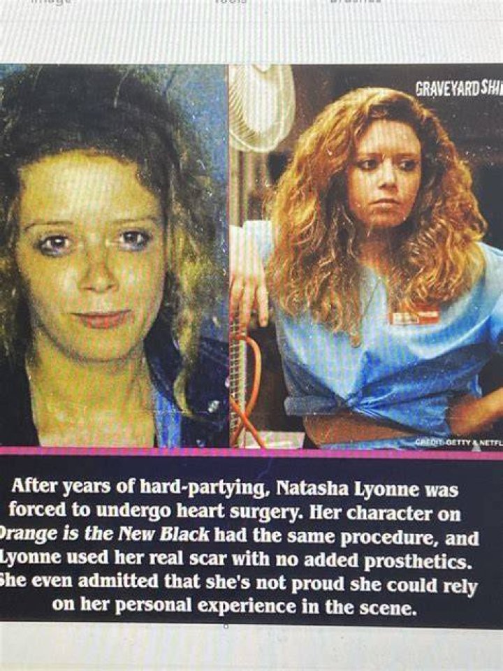 Natasha Lyonne's Scar And Its Untold Story