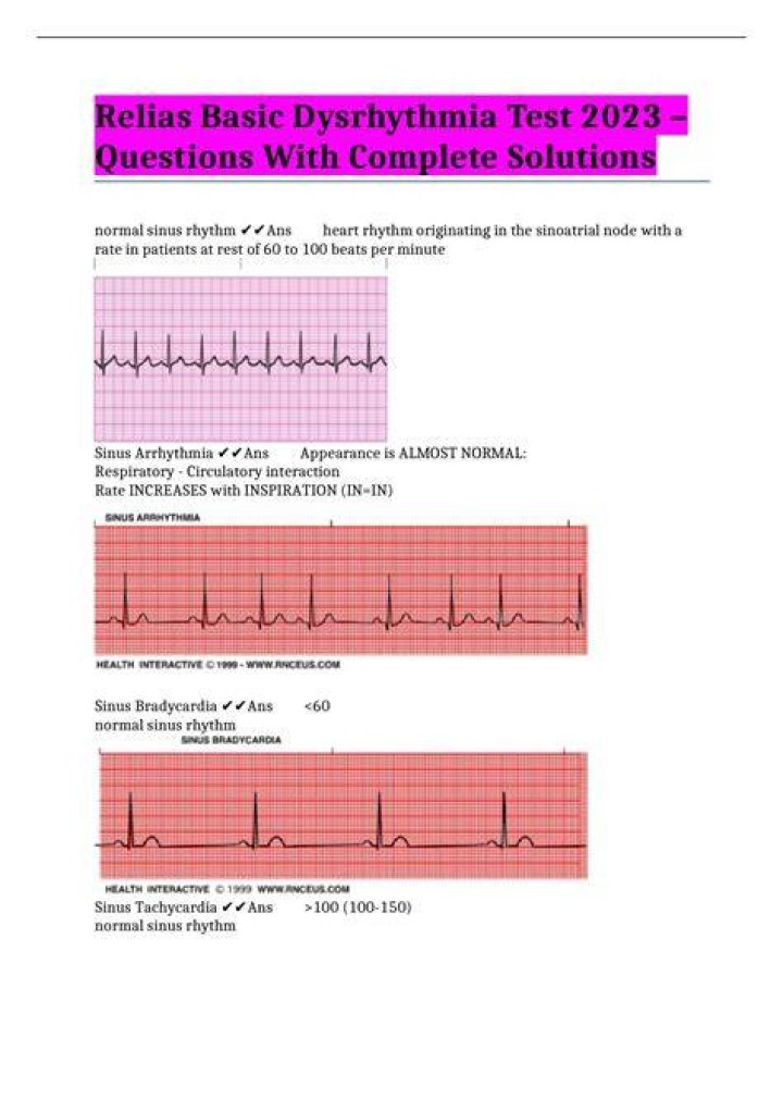 Relias Dysrhythmia Test 2023 Questions and AnswersVerified Answers
