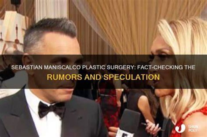 Sebastian Maniscalco’s Plastic Surgery Did the 49YearOld Comedian