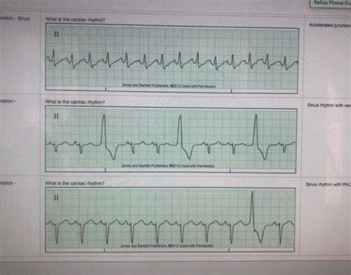 Solved Relias Phone ou tation Sinus What is the cardiac